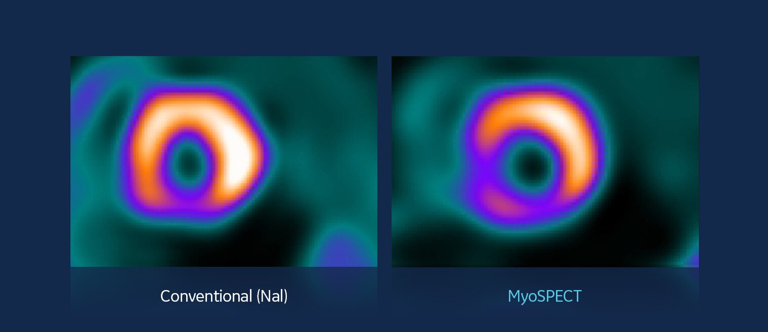 GEHC MyoSPECT PWP Image Quality Image 1