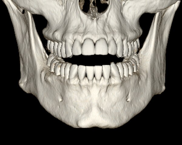 Erweiterte Visualisierung in DentaScan