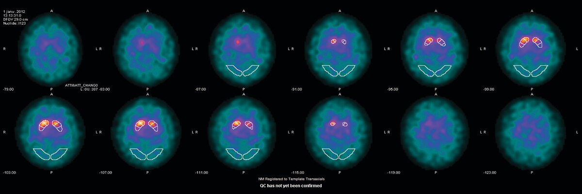 DaTQUANT | GE Healthcare (Germany)
