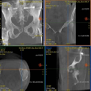 product-product-categories-Interventional - 2016-needle_21.jpg