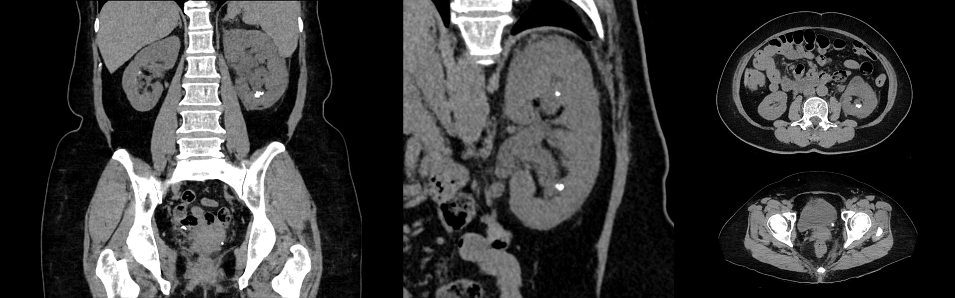 klinische Ergebnisse des diagnostischen CT