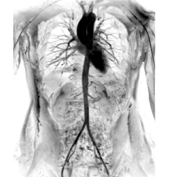 product-product-categories-magnetic-resonance-imaging-signa premier-1.png