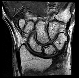 product-product-categories-magnetic-resonance-imaging-signa premier-2.png