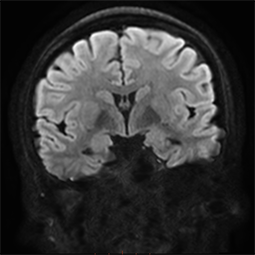 product-product-categories-magnetic-resonance-imaging-signa premier-3.png