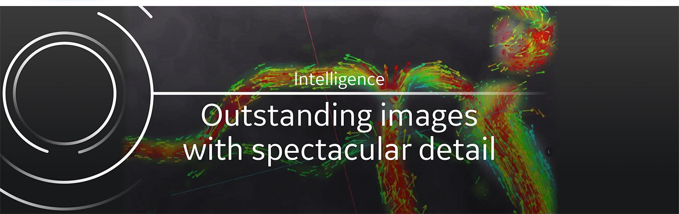 Intelligente Bildgebung für sehr detailierte Bilder