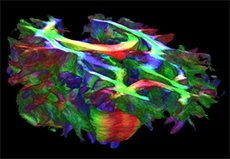 product-product-categories-magnetic-resonance-imaging-signa premier-Image1.png