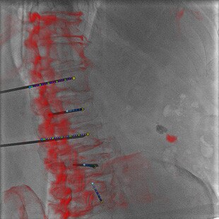 product-product-categories-Interventional - 2016-needle_12.jpg