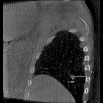 product-product-categories-Interventional - 2016-needle_31.jpg