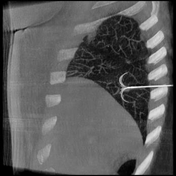 product-product-categories-Interventional - 2016-needle_33.jpg