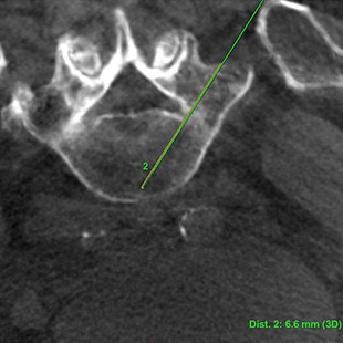CT-categories-interventional-x-ray-igs-for-hybrid-or-discovery igs 730-nadelassistent-1.jpg