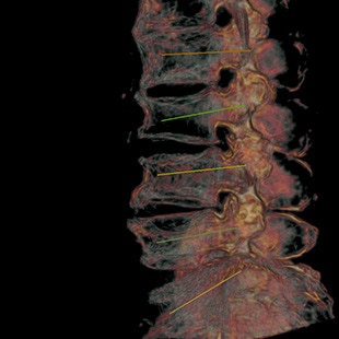 CT-categories-interventional-x-ray-igs-for-hybrid-or-discovery igs 730-nadelassistent-3.jpg