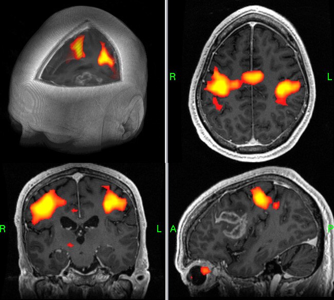 GE Healthcare BrainWave